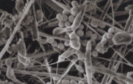 untreated filter microscope view